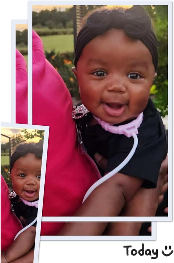 Toddler Doctor Kit - 12 Pieces & Carry Case - Dr Pretend Play Medical Toys, Kids Doctor Play Set for 3 4 5 6 7 8 Year Old Girl Birthday Gifts (Pink)